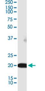 BRI3BP Antibody in Western Blot (WB)