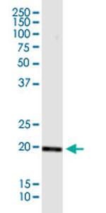 BRI3BP Antibody in Western Blot (WB)