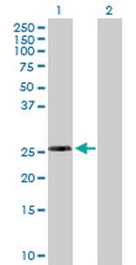 RPL10L Polyclonal Antibody, MaxPab™
