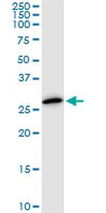 PSMA8 Antibody in Western Blot (WB)