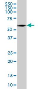 SESN3 Antibody in Western Blot (WB)