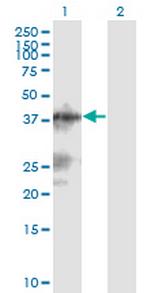 C13orf31 Monoclonal Antibody (2A1)