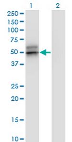 SERPINA12 Monoclonal Antibody (3B3)