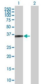 ZADH1 Polyclonal Antibody, MaxPab™