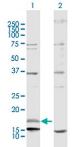 NRG4 Antibody in Western Blot (WB)