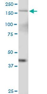 TTBK2 Antibody in Western Blot (WB)