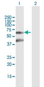TTBK2 Antibody in Western Blot (WB)