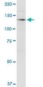 CDAN1 Monoclonal Antibody (7A10)