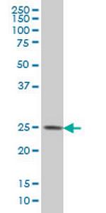 CKLFSF4 Monoclonal Antibody (6G4)
