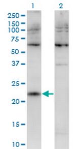 CMTM4 Monoclonal Antibody (1B9)