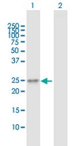TMED6 Polyclonal Antibody, MaxPab™