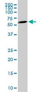 HIPK4 Antibody in Western Blot (WB)