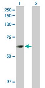 ZNF599 Polyclonal Antibody, MaxPab™