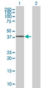 ZNF558 Polyclonal Antibody, MaxPab™