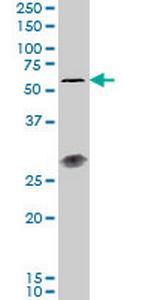 IL23R Monoclonal Antibody (3D7)