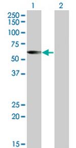 CESK1 Monoclonal Antibody (4G6)