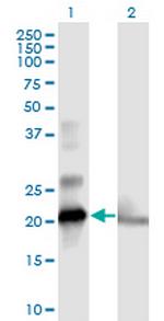 COMMD1 Polyclonal Antibody, MaxPab™