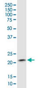 COMMD1 Antibody in Western Blot (WB)