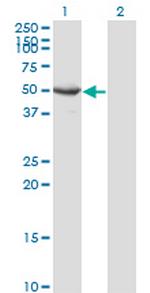SEPT10 Monoclonal Antibody (3A9)