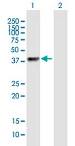 ZNF385B Polyclonal Antibody, MaxPab™