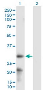 ARL6IP6 Polyclonal Antibody, MaxPab™