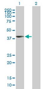 UPP2 Polyclonal Antibody, MaxPab™