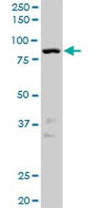 NEK10 Antibody in Western Blot (WB)