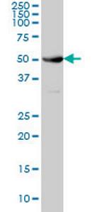 NEK10 Antibody in Western Blot (WB)