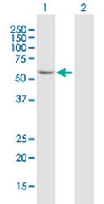 FGD5 Antibody in Western Blot (WB)