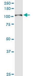 DAB2IP Monoclonal Antibody (8C10)
