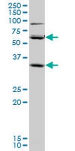SLC36A2 Monoclonal Antibody (2H3)