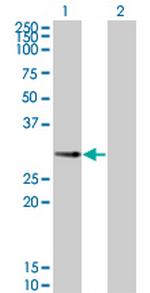 PPP1R2P3 Monoclonal Antibody (2G11)