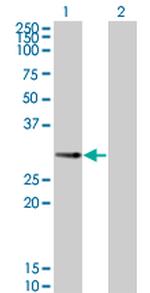 PPP1R2P3 Antibody in Western Blot (WB)