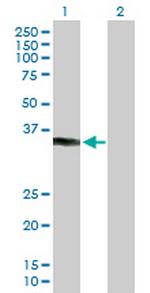 KCTD7 Polyclonal Antibody, MaxPab™