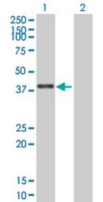 ZNF783 Antibody in Western Blot (WB)