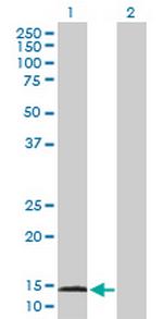 AGR3 Antibody in Western Blot (WB)