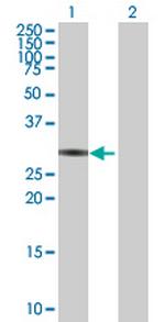 ZNF483 Antibody in Western Blot (WB)
