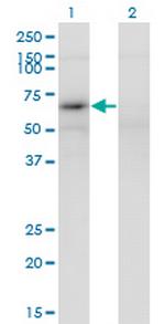 MAGEB6 Monoclonal Antibody (2C11)