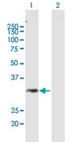 DGAT2L3 Polyclonal Antibody, MaxPab™