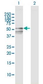 RBMY1F Polyclonal Antibody, MaxPab™