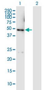 DYX1C1 Polyclonal Antibody, MaxPab™