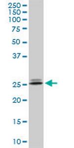 PHOSPHO1 Monoclonal Antibody (1A11)