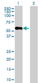 KRT25D Polyclonal Antibody, MaxPab™