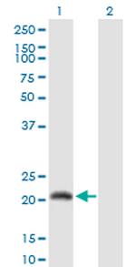CALML6 Antibody in Western Blot (WB)