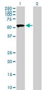 SASS6 Polyclonal Antibody, MaxPab™