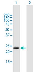 CABP7 Polyclonal Antibody, MaxPab™