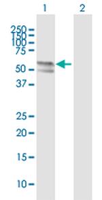 TMPRSS6 Polyclonal Antibody, MaxPab™