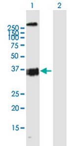 OXER1 Polyclonal Antibody, MaxPab™