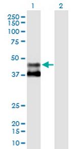 MMAA Polyclonal Antibody, MaxPab™