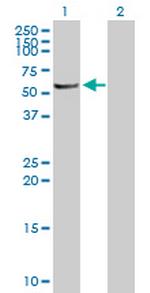 MGC42105 Antibody in Western Blot (WB)